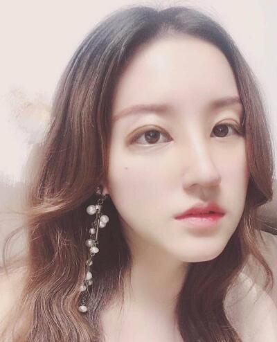 北京葉子整形肋軟骨隆鼻案例術(shù)后一個月