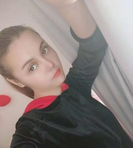 長沙雅美眼鼻整形案例分享，術(shù)后這滿滿的混血感是腫么回事