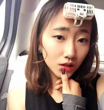 武漢藝星整形岳金堂醫(yī)生雙眼皮案例術(shù)后三個月效果反饋