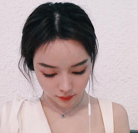 廈門新生植發(fā)種植發(fā)際線三個(gè)月 廈門新生植發(fā)種植發(fā)際線三個(gè)月