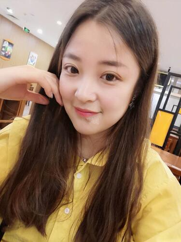 西安時(shí)光整形郭淑華雙眼皮案例術(shù)后一個(gè)月