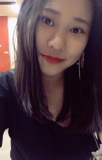 肇慶華美整形切開雙眼皮術(shù)后三個月效果分享，這不比貼雙眼皮香？