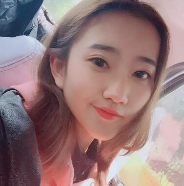 武漢藝星整形岳金堂醫(yī)生雙眼皮案例術(shù)后三個(gè)月 武漢藝星整形岳金堂醫(yī)生雙眼皮案例術(shù)后三個(gè)月