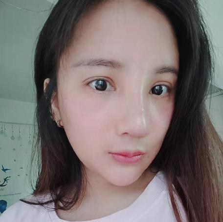 天津文怡整形水光針效果分享，化出來的好皮膚不如真的好皮膚