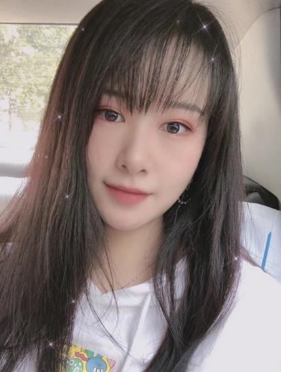 南方醫(yī)院整形美容科顴骨內(nèi)推一個月