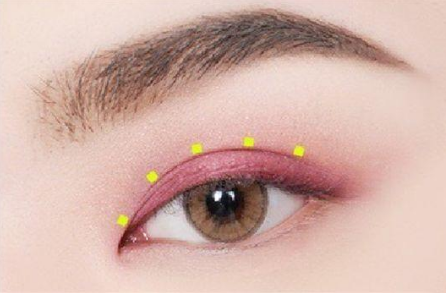 安徽醫(yī)科大學(xué)第二附屬醫(yī)院整形美容中心做雙眼皮