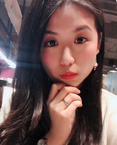 汕頭曙光整形皮秒激光祛斑一個(gè)月效果反饋，斑沒了