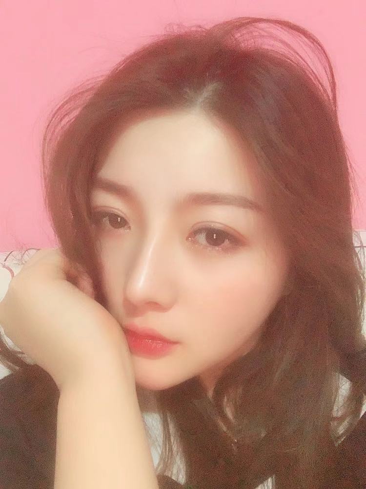 北京圣嘉榮二次鼻修復(fù)術(shù)后兩個月