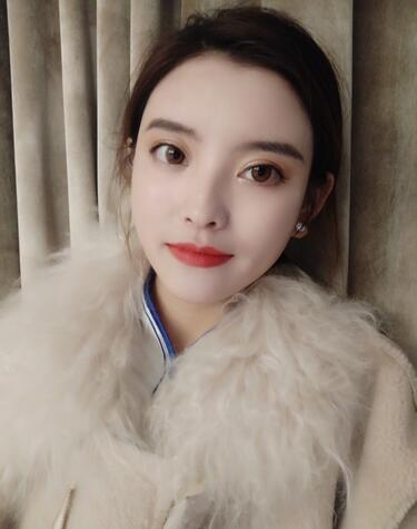 上海首爾麗格樸興植下頜角整形兩個(gè)月 上海首爾麗格樸興植下頜角整形兩個(gè)月