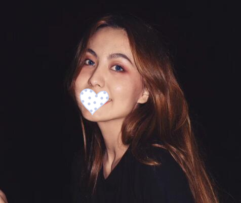 徐州時光洪揚(yáng)整形雙眼皮案例分享，好看到詞窮