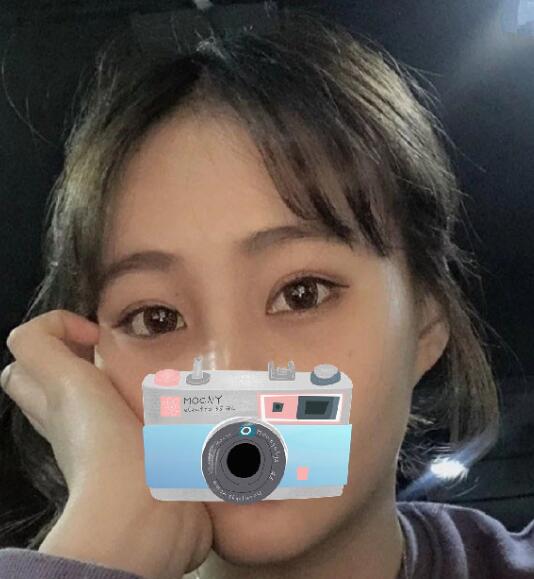 重慶華美整形下頜角整形術后三個月效果