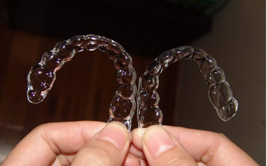 自貢華醫(yī)整形金屬托槽矯正結(jié)束,佩戴保持器 自貢華醫(yī)整形金屬托槽矯正結(jié)束,佩戴保持器