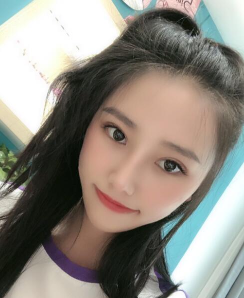 煙臺華怡整形張上海切開雙眼皮一個月效果 煙臺華怡整形張上海切開雙眼皮一個月效果