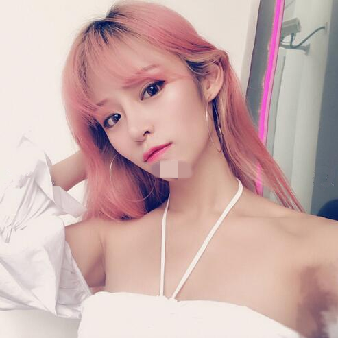 北京崔相平整形雙眼皮修復(fù)兩個月效果