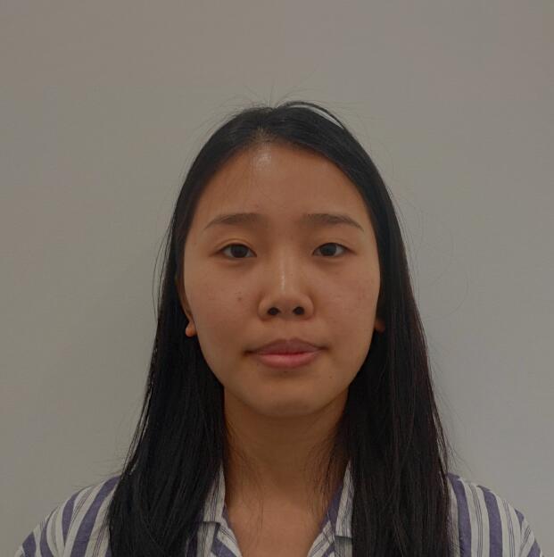 煙臺華怡整形張上海切開雙眼皮前 煙臺華怡整形張上海切開雙眼皮前