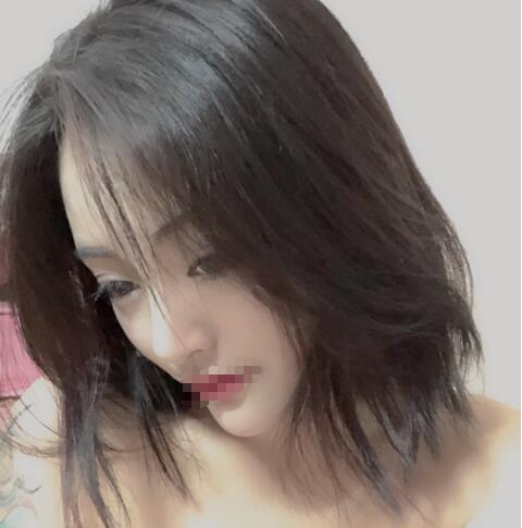 上海賽美瑞整形張化舉鼻綜合一個(gè)月效果