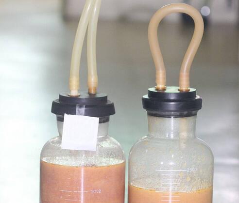 青島大學(xué)醫(yī)學(xué)院附屬醫(yī)院整形美容燒傷科陳振宇雙腿吸脂吸出的脂肪