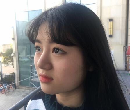 西安希美得整形瘦臉針瘦臉前