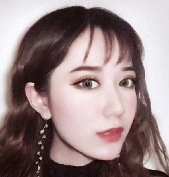 上海藝星整形崔海天下頜角整形術(shù)后三個月效果