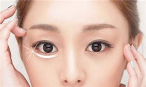 北京京民整形祛眼袋