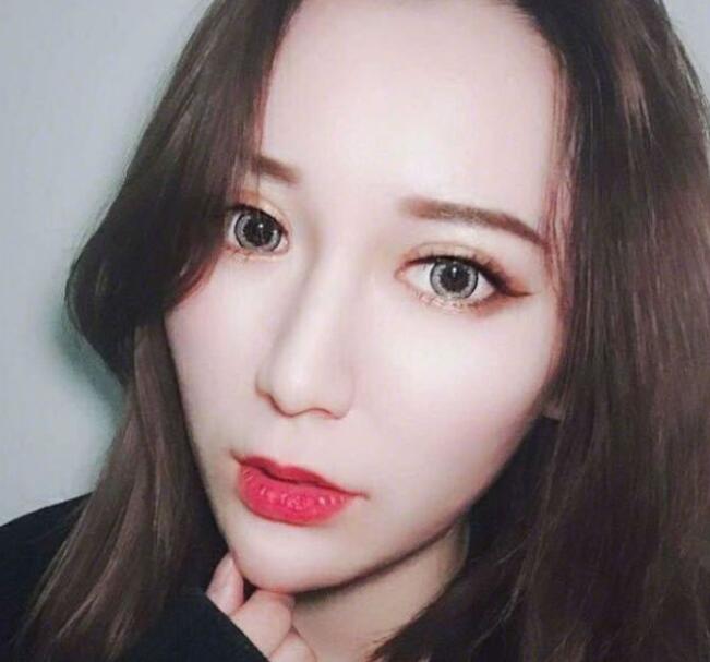 上海藝星整形崔海天下頜角整形術(shù)后兩個月效果