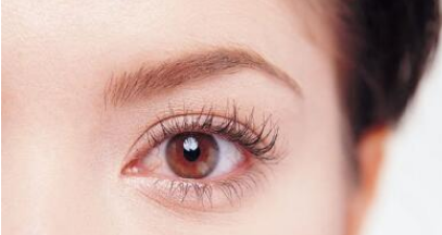 成都劉影美容整形做雙眼皮