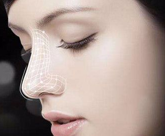 大連醫(yī)科大學附屬第一醫(yī)院做自體軟骨隆鼻術后效果