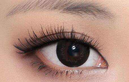 福州新時代美容雙眼皮術后效果