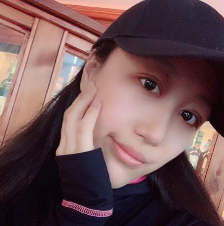 上海華美楊亞益做眼部修復(fù)案例效果對(duì)比圖 上海華美楊亞益做眼部修復(fù)案例效果對(duì)比圖