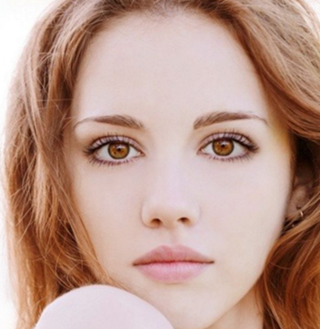 廣州尚美善造雙眼皮術(shù)后效果