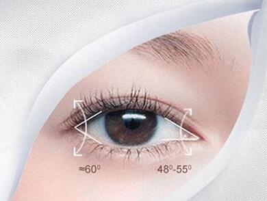 哈爾濱三精女子?？普伍_眼角術(shù)后效果