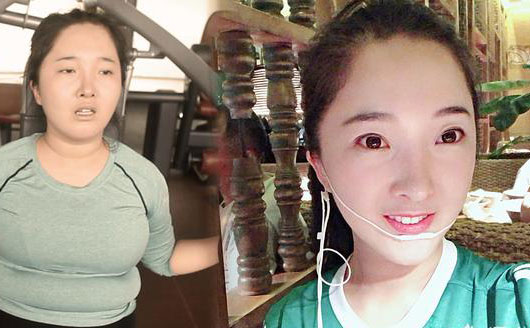 埋線減肥是什么?這種減肥做法具有科學性嗎?