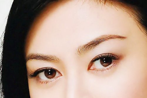 懷化華美美萊整形開(kāi)眼角