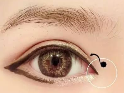 黃岡皇氏醫(yī)療美容醫(yī)院開眼角