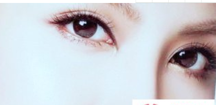 淮北天煌美容整形醫(yī)院開內(nèi)眼角