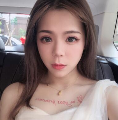 長沙梵童王志軍自體脂肪填充案例效果對比