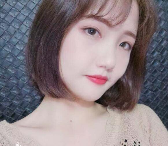 做切開雙眼皮恢復(fù)中的我