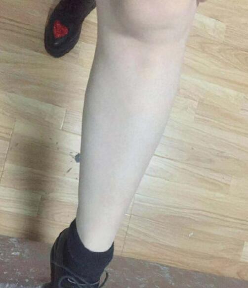 宋君醫(yī)生激光脫毛手術(shù)最終效果圖對(duì)比