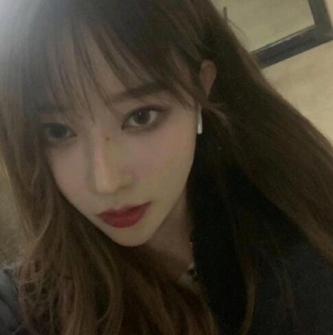 玻尿酸豐下巴完全恢復(fù)后的效果