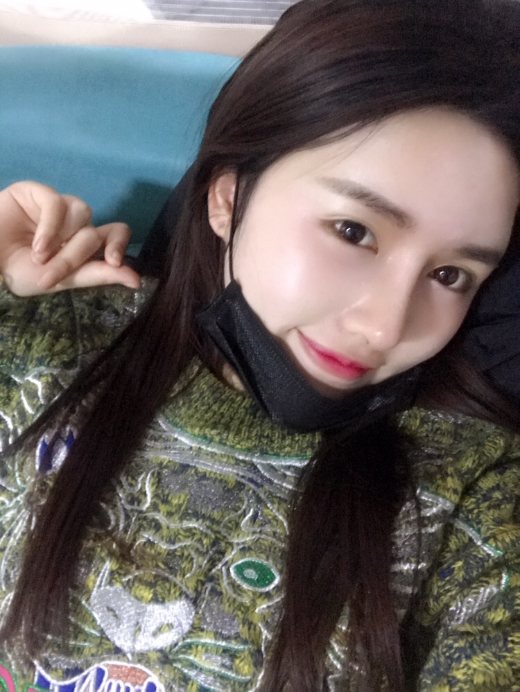 膨體隆鼻手術后 膨體隆鼻手術后