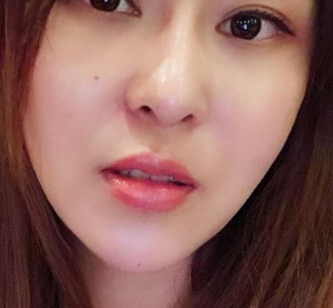 來(lái)到鄭州優(yōu)恩醫(yī)療美容醫(yī)院