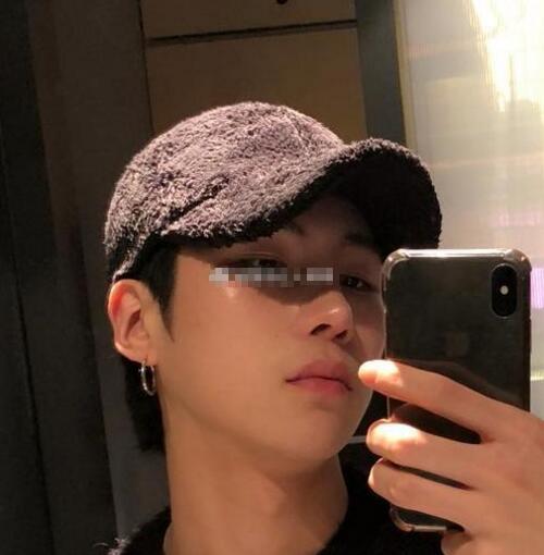 徐學東男士下頜角手術(shù)后的療效