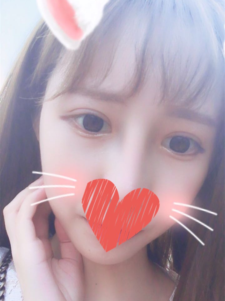 杜園園開外眼角案例效果對比圖 杜園園開外眼角案例效果對比圖