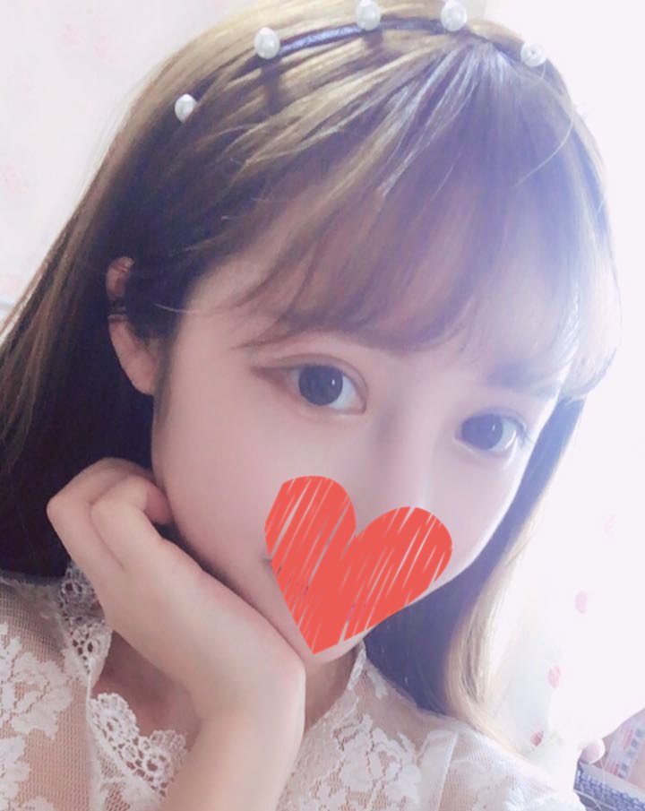 杜園園開外眼角案例效果對比圖 杜園園開外眼角案例效果對比圖