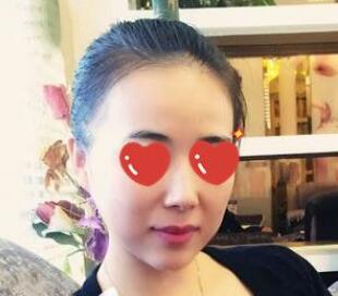 上海美萊醫(yī)療美容門診部伊維蘭隆下巴的優(yōu)勢 上海美萊醫(yī)療美容門診部伊維蘭隆下巴的優(yōu)勢