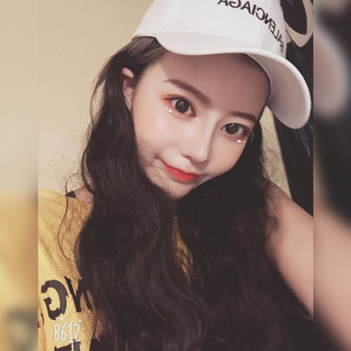 嘉興曙光美容醫(yī)院整形專家王良發(fā)做假體隆鼻怎么樣？王良發(fā)假體隆鼻案例