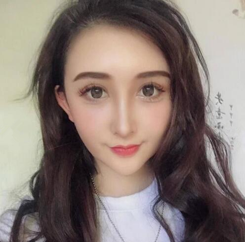 昆明維多利亞整形專家成昌燮做自體脂肪填充效果怎么樣？成昌燮隆鼻案例分享