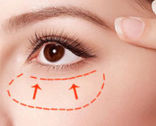 深圳廣濟(jì)門診部醫(yī)療美容科激光祛眼袋