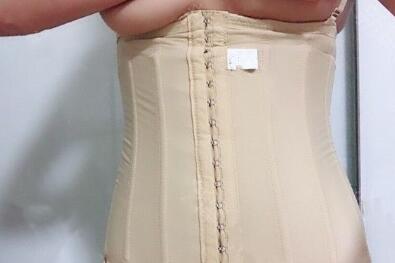 顧鵬腹部吸脂案例展示