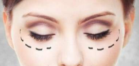 上海時光整形外科醫(yī)院激光祛眼袋